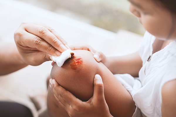 heridas en bebés